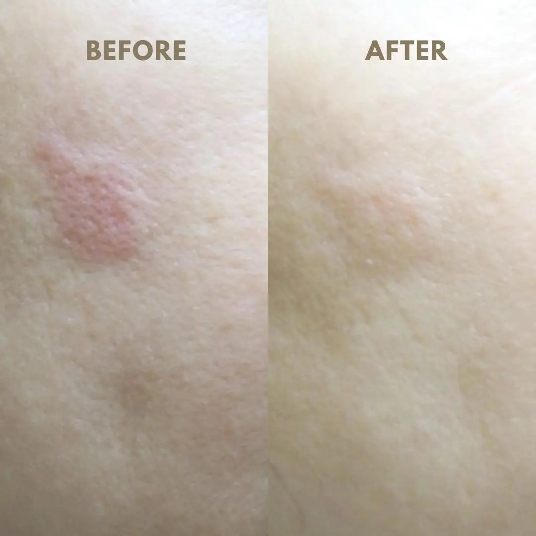 Klear™ Revitalizing Sheet Mask – 28 g | Collagen & Niacinamide